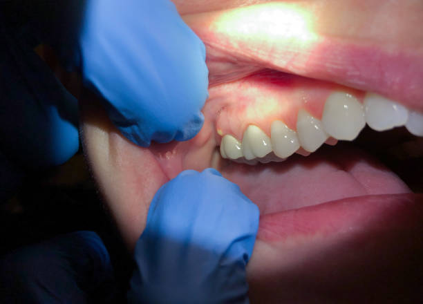 Best Emergency Root Canal Treatment in Garden Grove, CA