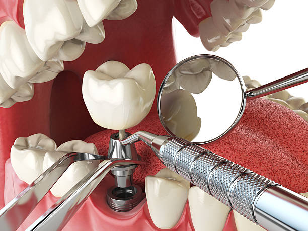 Best Emergency Treatment for Toothache in Garden Grove, CA